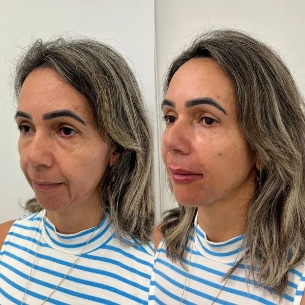 30